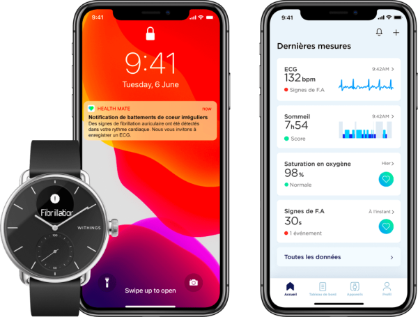 La montre connectée ScanWatch de Withings disponible dans l'application e-Baros